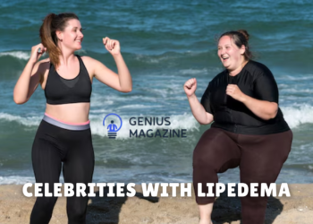 celebrities with lipedema
