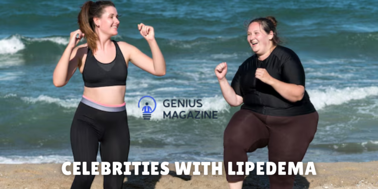 celebrities with lipedema